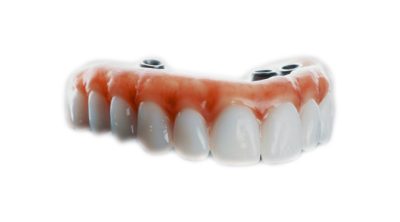 denture_allonX_03